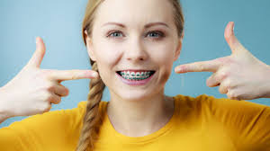 Wax is often applied to protruding brackets, wires and other areas where rubbing with the gumline occurs. 13 Things You Need To Know About Your First Week With Braces