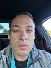 1st race of the year in the books. Hit a PR (26:19) and caught an allergic… 