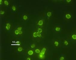 Cryptosporidium is a genus of protozoan pathogens which is categorized under the phylum apicomplexa. Cryptosporidium Parvum Wikipedia