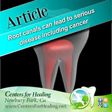 Root Canals Can Lead To Serious Disease Including Cancer Http Centersforhealing Net Root Canals Can Lead To Serious Disease Includ Root Canal Cancer Dental