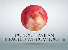 See full list on mayoclinic.org Pin On Dental Info