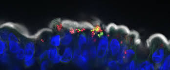 New Salmonella discovery opens pathway for treating food-borne infections