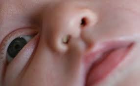 Cuidados Del Recien Nacido Como Limpiar La Nariz Del Bebe Cuidados Del Recien Nacido Cuidados De Bebes Bebes Recien Nacidos Cuidados