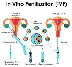 Islam has provided alternatives for the haram things. 6 Things Women Trying Ivf To Get Pregnant Want You To Know Health