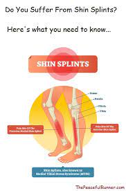 Do You Have Shin Splints Here S What You Need To Know