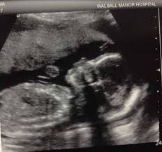 I have zero interest in any cat toys and i love to roll around in catnip for my hours of fun. Can T Wait To Meet You Son Hello Mrsshilts