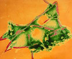 Prions What Is Microbiology Microbiology Society