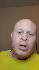 Hilarious Albino Comedy Sketch by Nathan Hurd