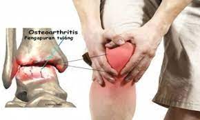 We did not find results for: Artikel Pengapuran Sendi Atau Osteoartritis