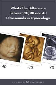 Pin On Gynecology Obstetrics