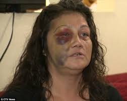 Winnipeg's Lana Sinclair tells of terrifying assault by police