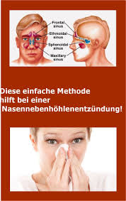 Diese Einfache Methode Hilft Bei Einer Nasennebenhohlenentzundung Beauty Hacks Sinusitis Life Hacks
