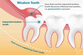 Pin On Dental Surgery