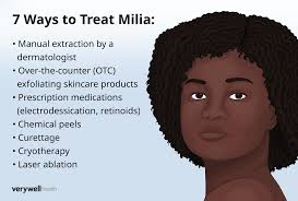 Image result for milium cyst on eyelid