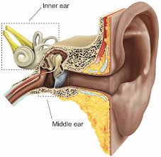 All three middle ear bones may be damaged. Stapedectomy Healthdirect