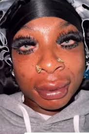 Omg. People need to stop the nonsense with looks and surgeries. For Gods  sake y'all want to look your very best in that situation regardless your  age right? I am 63 and