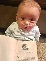 The Boy Who Lived When I was pregnant with my son Brayden, things took a  tough turn when I was 17 weeks pregnant. During a routine ultrasound to  find out if we