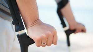 Entzundungsbedingte Nervenschaden Nach Huftprothesenoperation Arthrose Journal