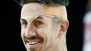 The Dribble podcast: Perth Wildcats teammates give Greg Hire more head  knocks, new nickname