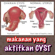 Membuatnya tetap sehat dan segar. Facebook