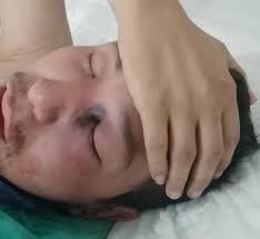 ¿desde cuando existe el hongo negro? Hongo Negro En Edomex Reportan Primer Caso Infeccion Ligada A Covid