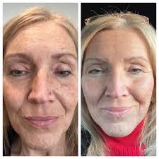 IS YOUR HOUSE DIRTY WITH NASTY, GREEN MOLD AND MILDEW?! LET'S WASH IT! 🏠🚿  Spring is just around the corner! Secure your spot