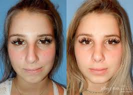 Leading Las Vegas Plastic Surgery