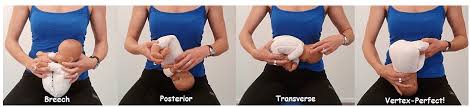 Optimal Fetal Positioning What You Need To Know Pregnancy