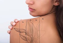 Rinse off the skin with warm water. How To Remove Permanent Tattoo 10 Effective Ways To Try