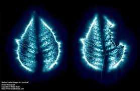 Before And After Kirlian Photography Spirit Science Science