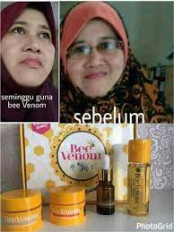 Bee venom is made by bees. Bee Venom Skincare Set 4 In 1