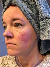 Hi beautiful ladies of Kinsale. If you've been thinking you'd like to use  more natural skincare products, this is your chance to learn about the best  natural ingredients to use