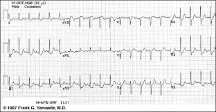 ecg learning center an introduction to clinical