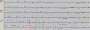 Intersample Overs in CD Recordings