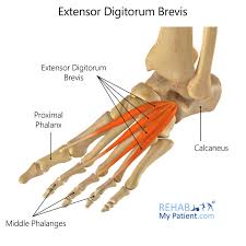 Disruption of the retinaculum can result in bowstringing or (24a) acute sprain of the inferior extensor retinaculum. Extensor Digitorum Brevis Rehab My Patient