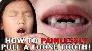 The following factors are often responsible for looseness in hardened plaque, known as tartar, causes the gums to pull away from the teeth, creating gaps that. How To Pull A Loose Tooth No Cry Teeth Pulling Method Easily Extract Baby Teeth Youtube