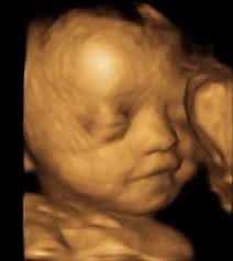 We offer elective 2d/3d/4d/hd ultrasounds to expectant mothers 15 weeks and on. Haylo3d Imaging