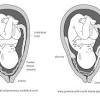 Exercise during the third trimester of pregnancy helps in many ways providing a good health benefits to the mother as. 3