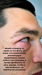 Маргарита и тарас степаненко считаются одной из самых образцовых пар в украинском дети, дом, чистота, порядок, скупиться, оплатить счета, приготовить покушать и другие текущие дела. Tknite Sebe Palcem V Glaz Zhena Stepanenko Pokazala Foto Travmy Muzha Novosti Dinamo Sport 24
