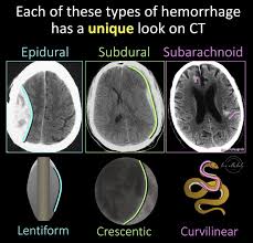 Image result for CT Head