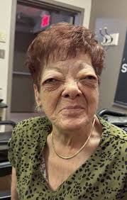 Simard, Marguerite (1955