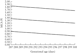 Reference Ranges For Umbilical And Middle Cerebral Artery