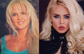 неудачные пластические операции российских звезд фото до и после Mariya Pogrebnyak Do I Posle Plastiki Grudi Izmenenie Vneshnosti Marii Pogrebnyak Do I Posle Plastiki Kakoj Razmer Nogi U Marii Pogrebnyak
