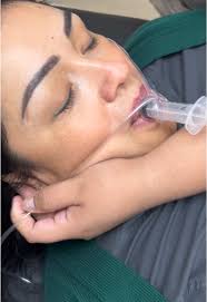 Fijacion De Tubo Endotraqueal Con Umbilical Y Tela Adhesiva