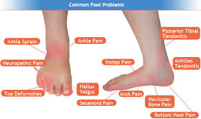 Pin On Orthotic Insoles