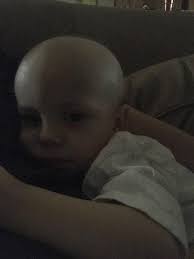 Any ones child had chemo of vincristine. Did they lose their hair with this  drug