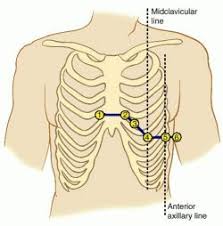 What Is Ecg Ekg Electrocardiogram