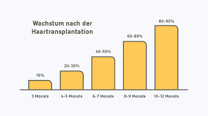 Bekannt durch srf1 puls, srf tagesschau, zdf, sat1 am abend, sat 1 das magazin, swr/ard/3sat. Nach Einer Haartransplantation Unser Ratgeber Qunomedical