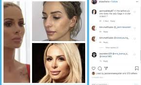 Married At First Sights Stacey Hampton: Surgeon reveals old nose | Daily  Mail Online