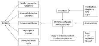 nodular regenerative hyperplasia evolving concepts on